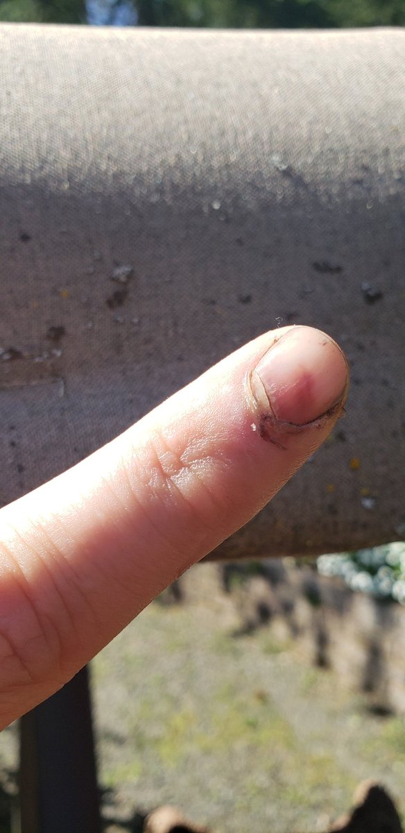 CrustyCaptain1's tweet photo. SIKE! You can go EAT SAND Big Moist! Check out this #crustyclaw! #crustinhoffman #crustinbieber #crusttillyoubust #crusticeisblind https://t.co/2M7gTjS00z