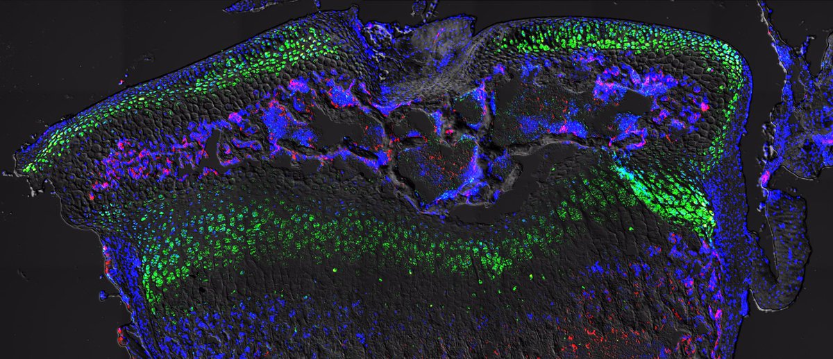 ShawnAHallett's tweet photo. Just shared my tissue processing protocol with @ACDbio for long 🦴

I hope this can be a helpful resource to musculoskeletal researchers utilizing RNAScope technology for their own studies 👍

#AcademicTwitter https://t.co/J9vxQpDuLA