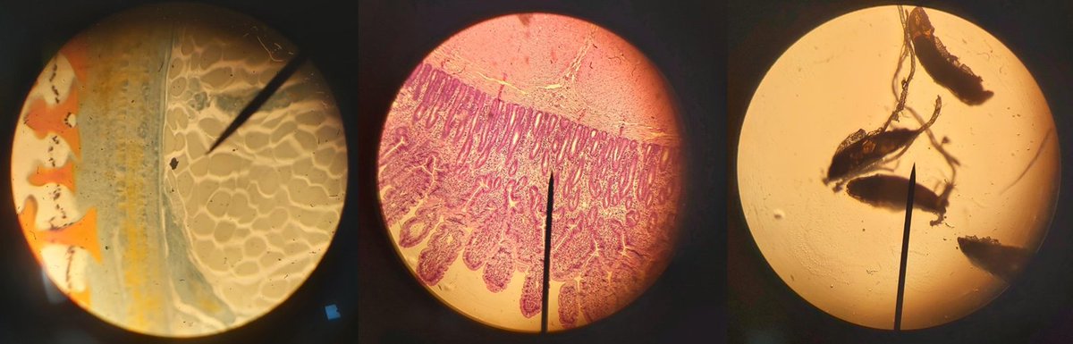 Sci_BHS's tweet image. Some of our S1s today were using microscopes for the first time where they were looking at certain tissues up close. They picked up the essential skills very quickly too; experts in the making!🔬