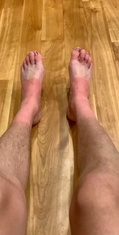 Great shot of my son’s feet after sitting on the beach with his flip flops on.  Nice strap marks. #TeenLife