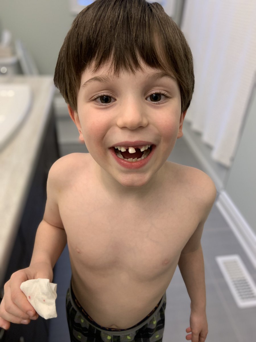 DisVacayFamily's tweet photo. Yesterday one front tooth fell out... Tooth Fairy visited last night... today, second front tooth fell out... this tooth Fairy gig is getting expensive! Huge inflation since when I was a kid! 😂
#toothless #toothfairy #frontteeth #babyteeth #barrie #barrieontario #simcoeontario https://t.co/ntuuiMIJXl