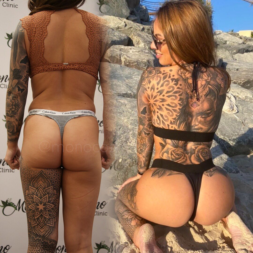 ClinicMono's tweet photo. Do you want attractive buttocks that are fuller and rounder, Safe Brazilian Butt lift cosmetic surgery in Mono Clinic may be the solution for you.🍑
#BrazilianButtLift #ButtockLift #Liposuction #ClinicMono #MonoClinic https://t.co/qQ58oDAm3W
