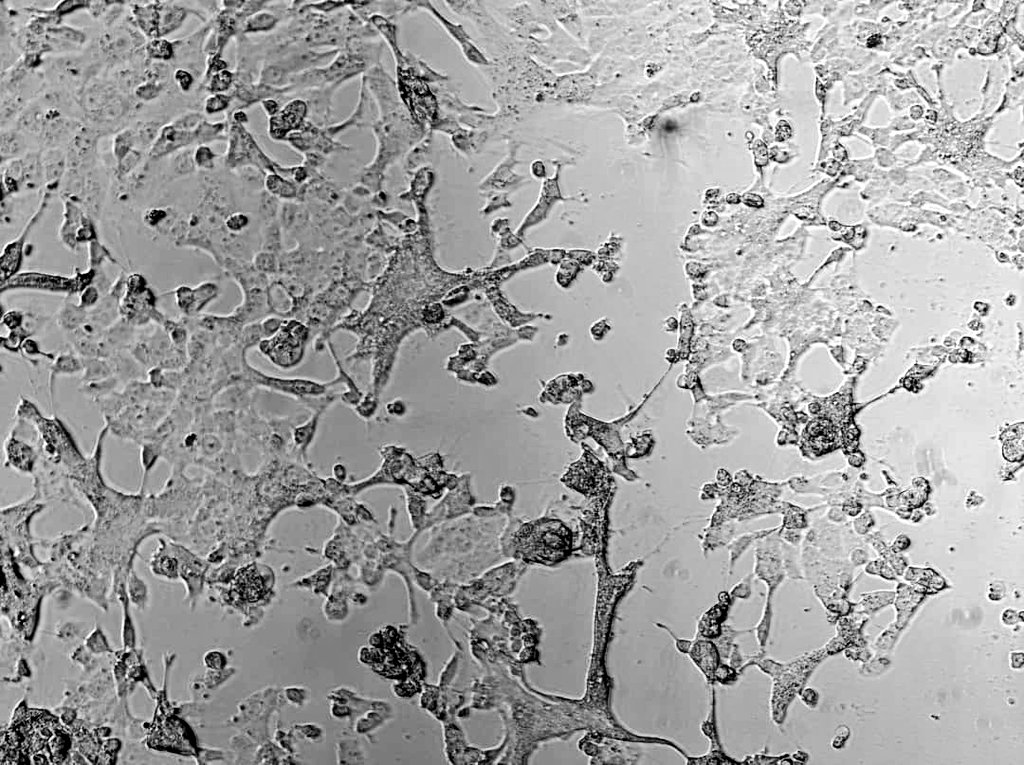 Gabrielasjr's tweet photo. A la izq., célula no infectada.

A la der., célula infectada con la variante brasileña P.1, a 48 horas de posinfección.

Estudios de infección «in vitro» muestran daño celular marcado, con muerte celular abundante.
Esta se evidencia como espacios vacíos en la capa de la célula. https://t.co/mhwvy56k03