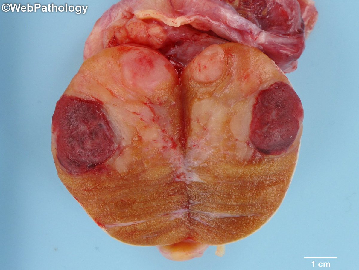 WebPathology tweet media