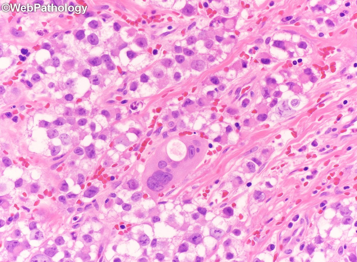 WebPathology tweet media