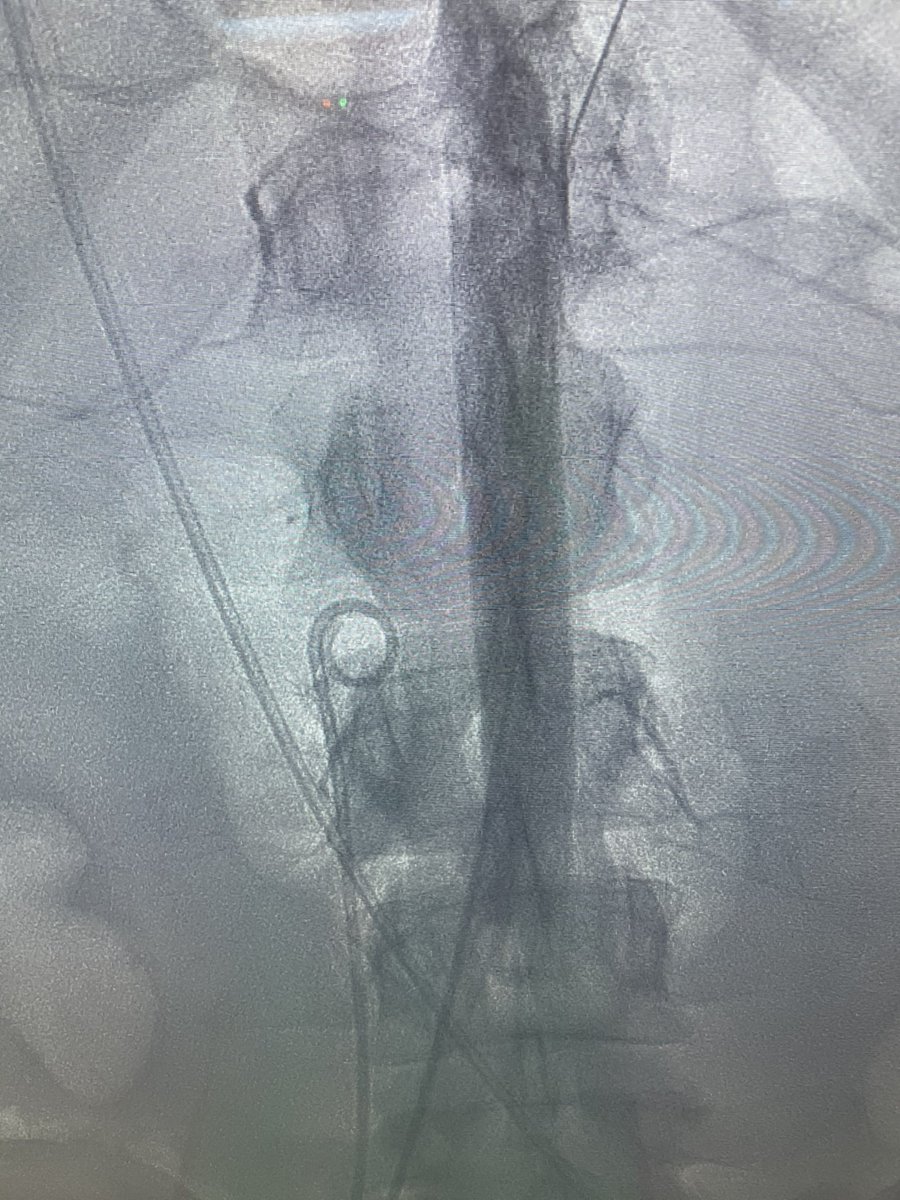 Amir Kaki, MD tweet media