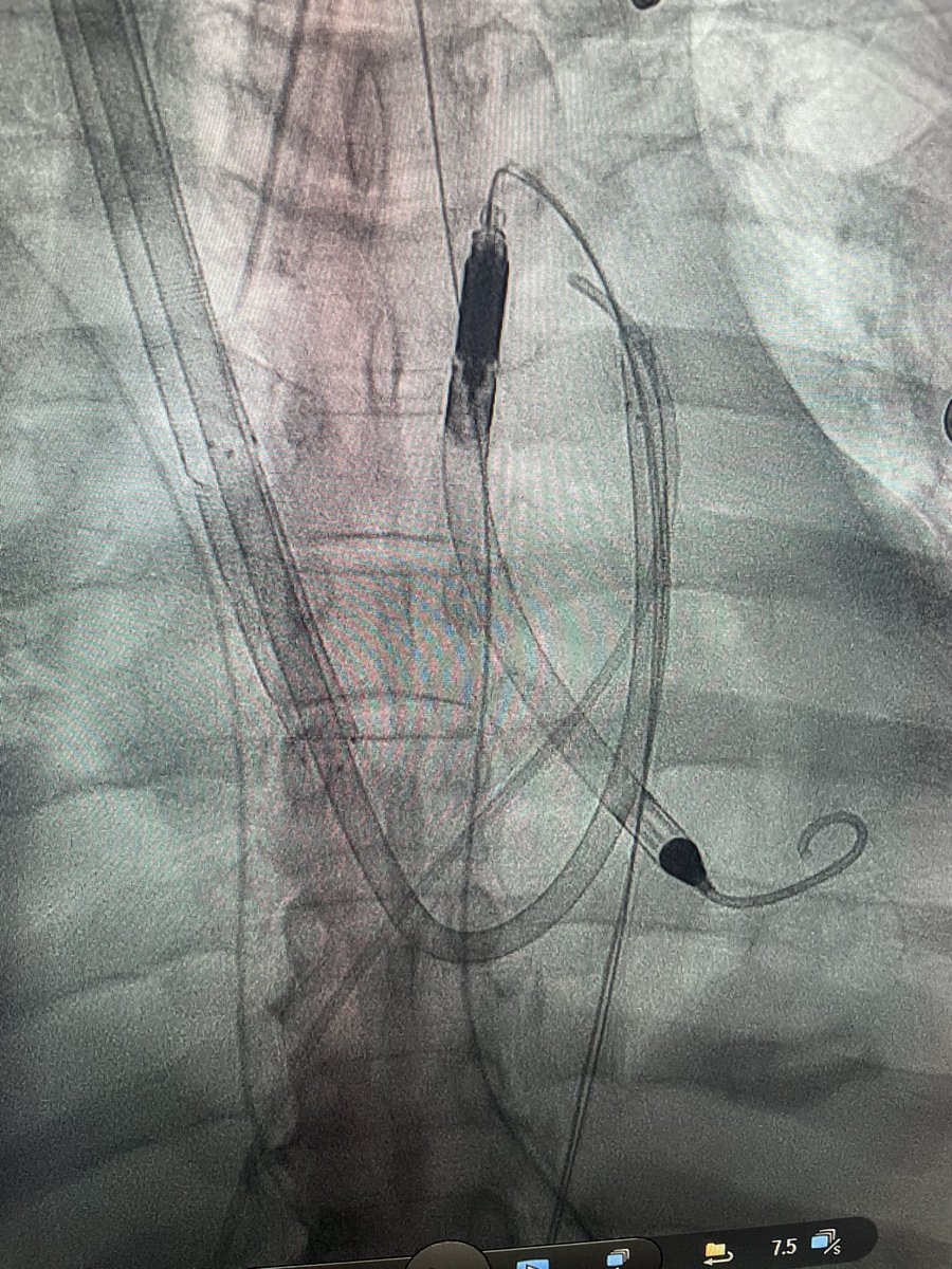 Amir Kaki, MD tweet media