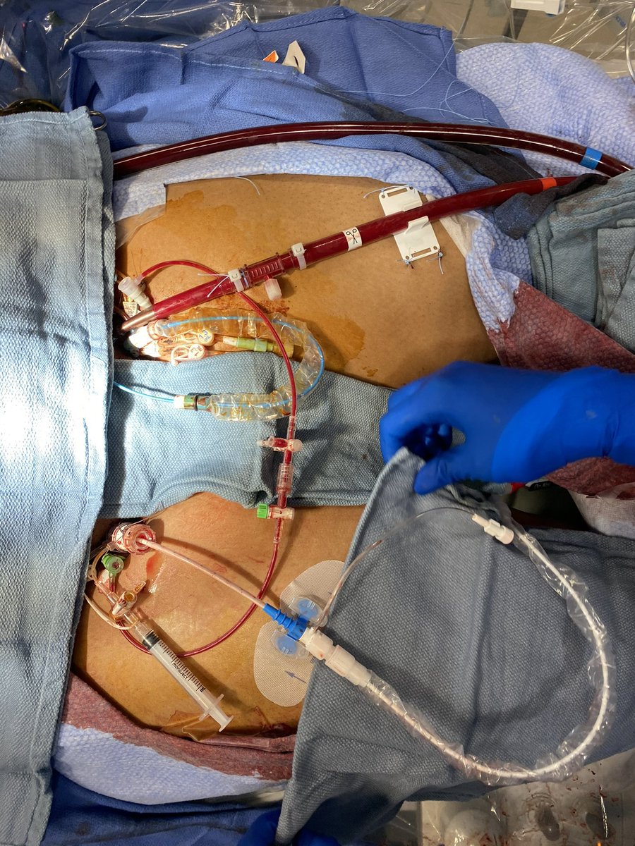 Amir Kaki, MD tweet media