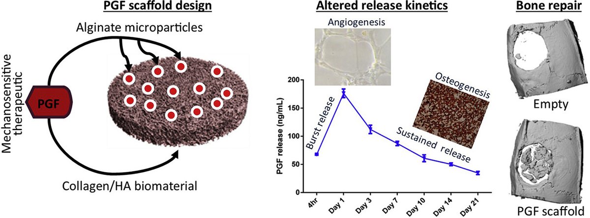 JCRnEDITORS's tweet photo. Mechanobiology-informed regenerative medicine: Dose-controlled release of placental growth factor from a functionalized collagen-based scaffold promotes angiogenesis and accelerates bone defect healing.
| Fergal J. O'Brien @RCSI_Irl | @fjobrien @UKICRS 
https://t.co/Xdv0LP0ED7 https://t.co/CMicCiY6LR