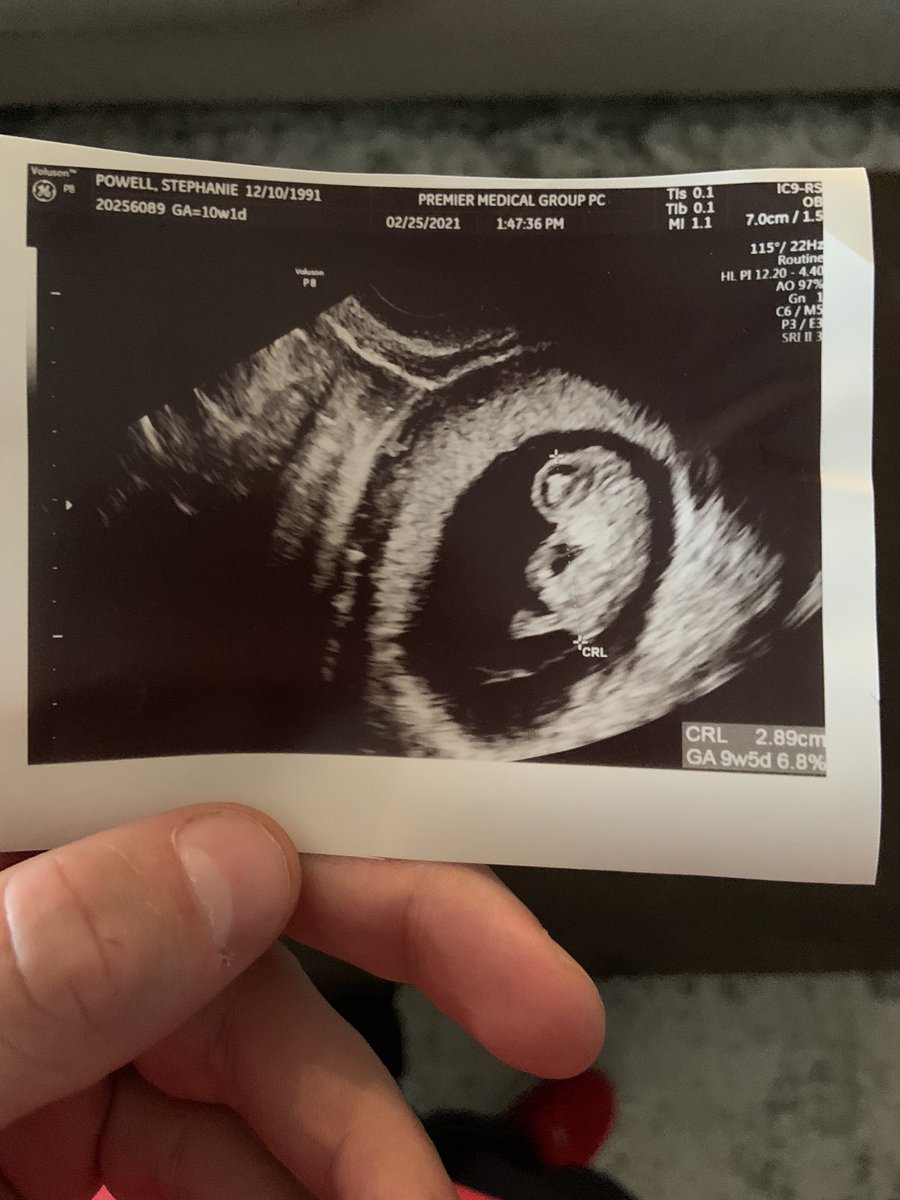 Mark Powell tweet media