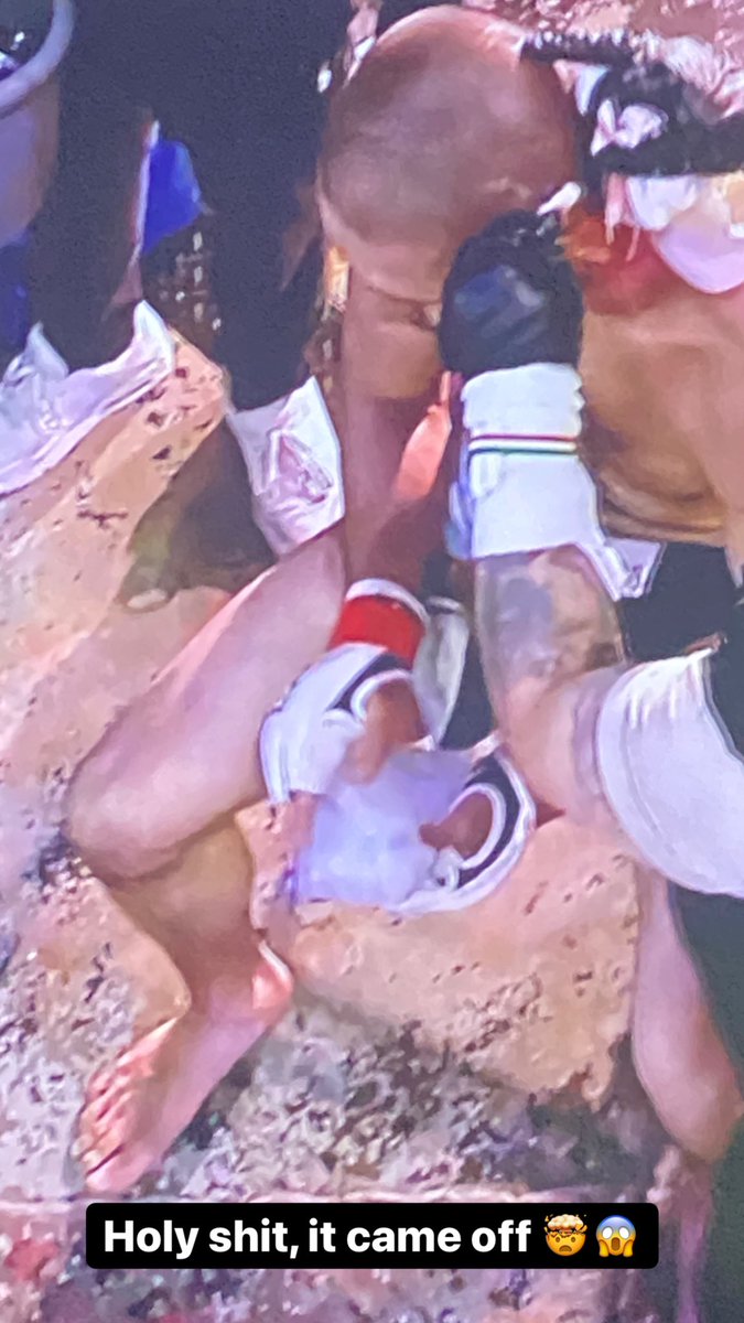 AngieOverkill's tweet photo. Just watched an old teammate kick a dude’s finger off on #CFFC 😖🥳😖 #DevinGoodale https://t.co/Ai33ERyeMF
