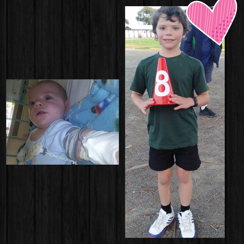 My youngest babe Ruben 10 years in the @RCHMelbourne and then last week. We're forever thankful for everything they've done for us. 
As I've said if you're in the position to do so please donate to the @GoodFriAppeal 
#GoodFridayAppeal #GiveForTheKids