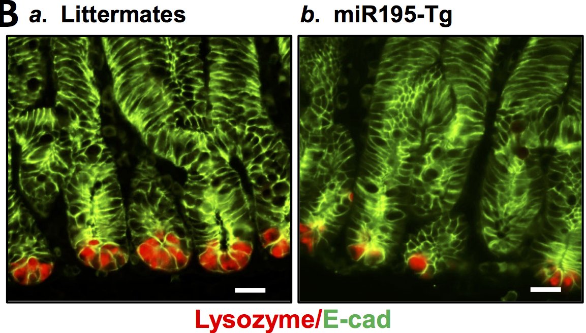 AJPCellPhys's tweet photo. @AJPCellPhys #ImageOfTheWeek highlights miR-195 regulation of #Paneth and Tuft cells in the small intestinal #epithelium. miR-195 transgene reduced Paneth cells (lysozyme-positive) and #lysozyme compared to WT control mice. Read more at https://t.co/0u3daQhuYJ https://t.co/ZxKFvLTj36