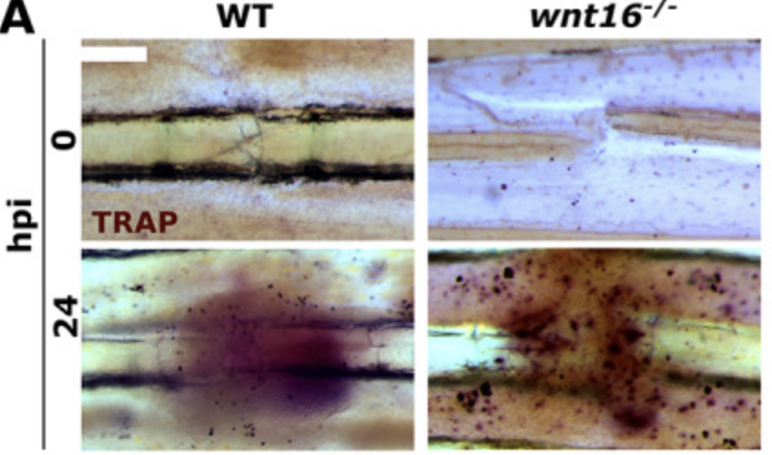 RobZondervan's tweet photo. #FractureFriday Wnt16 elicits a protective effect against fractures likely by modulating runx2a to facilitate osteoblast differentiation and bone matrix deposition.
@ASBMR 
https://t.co/C4ovgzex5r
@ORSsociety @isfrfractures #TweetTheTib https://t.co/L8RX9CiUjL