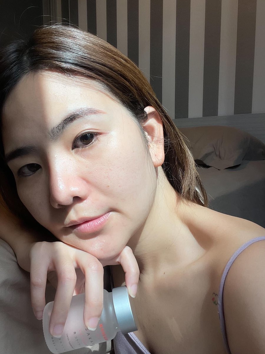 มึงงงง เอาจริงปะถ้าของมันไม่ดีนี่ไม่อวยให้โดนด่าหรอก แต่ดูนี่ คนที่กินคือผิวใสแบบใสชห ใสสุขภาพดีอะ skin barrier แข็งแรงขึ้นมากกกโดนแดดแรงๆไม่แสบผิว รูขุมขนก็กระชับ ที่สำคัญเห็นผลโคตรไว #ซาคานะ #ของดีบอกต่อ #ใช้จริงรีวิวจริง #รีวิวสกินแคร์ #รีวิวคอลลาเจน