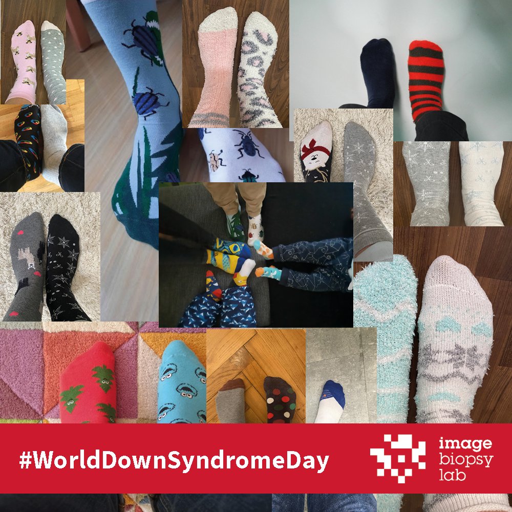 ImageBiopsyLab's tweet photo. Did you know that the 21st of March matches the 3 copies of chromosome 21, unique to people with Down Syndrome?
Rock the odd Socks today!
#imagebiopsylab #worlddownsyndromeday #LotsofSocks https://t.co/BJp6kwJ8uf