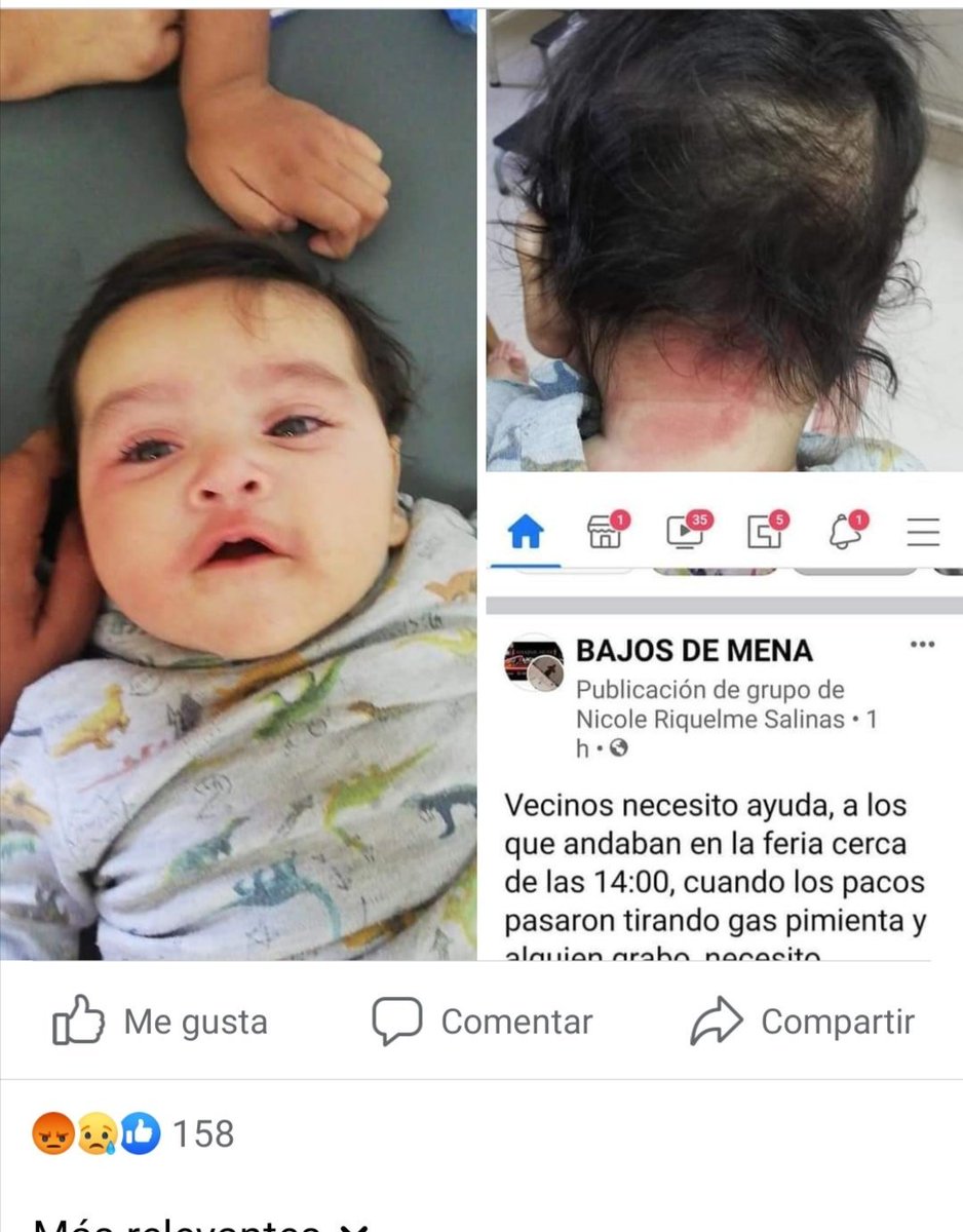 notxtremo's tweet photo. #PacosMaricones
Llamado a todas la organizaciones a REPUDIAR ENFÁTICAMENTE y con OBJETIVIDAD, esta GRAVE situación ocurrida en la feria libre de Puente Alto.
donde Carabineros de Chile gaseó INDICRIMINADAMENTE
@CIDH @ONU_derechos @ONUMujeres @uniceflac @hrw_espanol @inddhh https://t.co/wkVHKifB9B