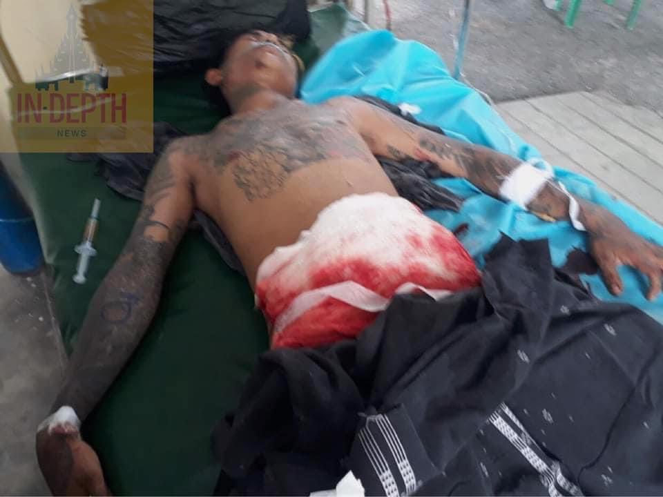 maytoekhine's tweet photo. TW // Blood
More than 6 civilians were shot with live ammunitions by military terrorists in Aung Pin Lal, #Mandalay and some in critical condition. #WhatsHappeningInMyanmar #Mar21Coup https://t.co/kB8FIJMrNW