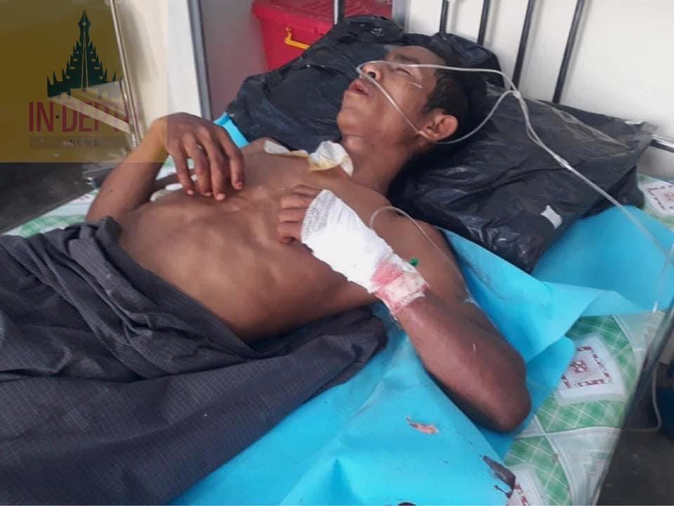 maytoekhine's tweet photo. TW // Blood
More than 6 civilians were shot with live ammunitions by military terrorists in Aung Pin Lal, #Mandalay and some in critical condition. #WhatsHappeningInMyanmar #Mar21Coup https://t.co/kB8FIJMrNW