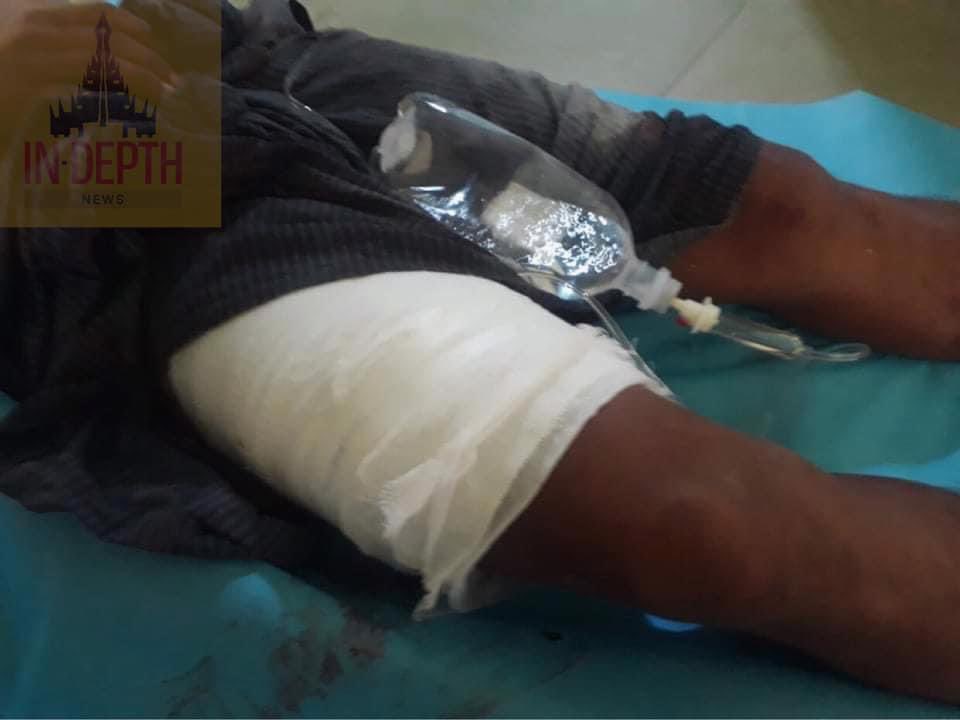 maytoekhine's tweet photo. TW // Blood
More than 6 civilians were shot with live ammunitions by military terrorists in Aung Pin Lal, #Mandalay and some in critical condition. #WhatsHappeningInMyanmar #Mar21Coup https://t.co/kB8FIJMrNW