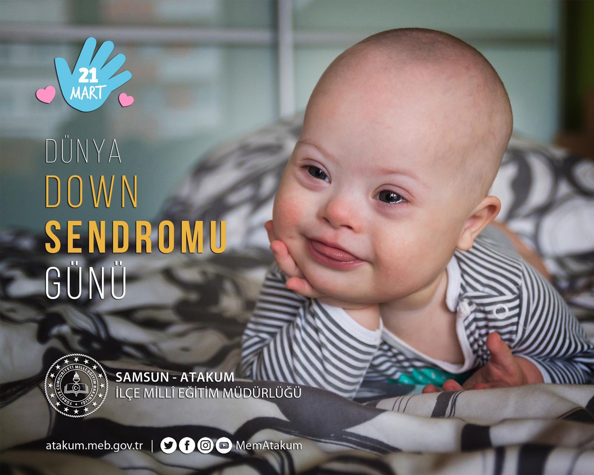 Kurupelit_io's tweet photo. #downsendromufarkındalıkgunu #gerçeksevgiengeltanımaz
@ziyaselcuk @CoskunESEN57 @KemalYl40895624 @irfanyetik55 @samsunmem @MemAtakum https://t.co/Be35G66DRW