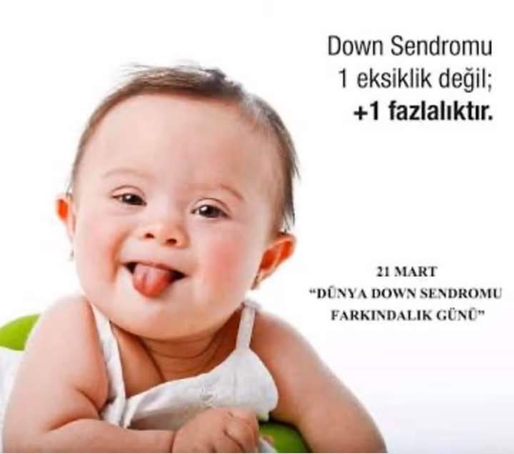 Gerçek Sevgi Kromozom Saymaz🌼#DownSendromuFarkındalıkGünü