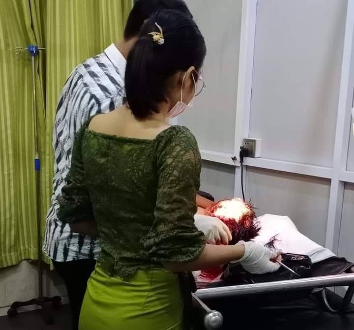 B851997's tweet photo. Tw // blood // graphic content⚠️
In Manawhari , MANDALAY, a man was chopped with knives by 4 military hired thugs around 8pm, last night. He got 3 cut wounds at his head &amp; back.

FREEDOM OF SPEECH 
#Mar21Coup
#WhatsHappeningInMyanmar https://t.co/ocskFKVdzg
