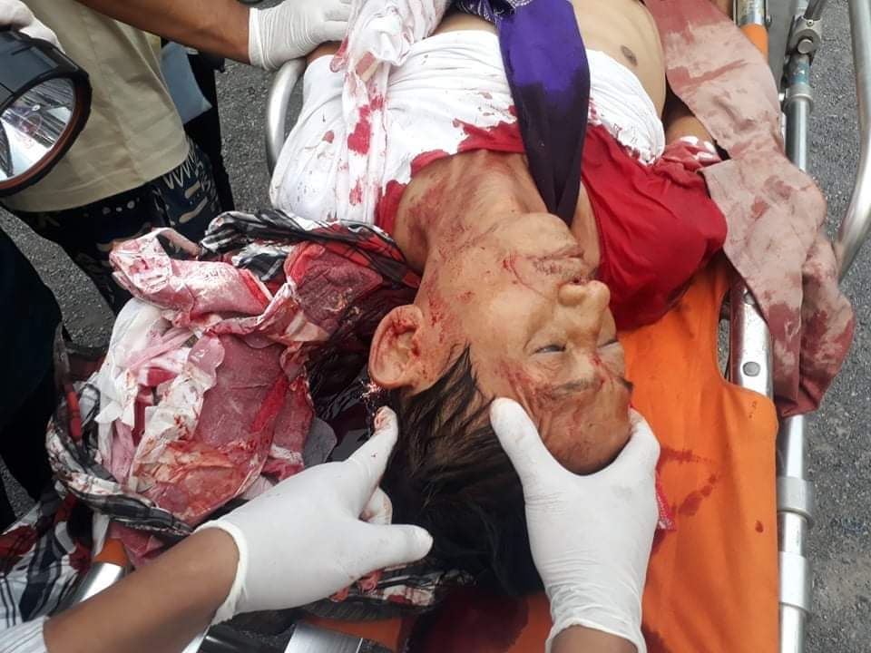 IrrawaddyNews's tweet photo. UPDATE

An anti-regime protester was killed and at least six were severely injured as soldiers and police used live rounds and rubber bullets on anti-regime protesters in #AungPinLae, #Chanmyatharzi Township, #Mandalay Region.

#WhatIsHappeningInMyanmar https://t.co/KGf6vBZGLh