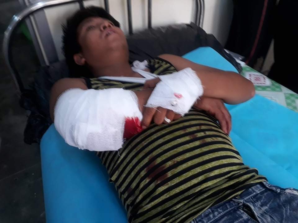 IrrawaddyNews's tweet photo. UPDATE

An anti-regime protester was killed and at least six were severely injured as soldiers and police used live rounds and rubber bullets on anti-regime protesters in #AungPinLae, #Chanmyatharzi Township, #Mandalay Region.

#WhatIsHappeningInMyanmar https://t.co/KGf6vBZGLh