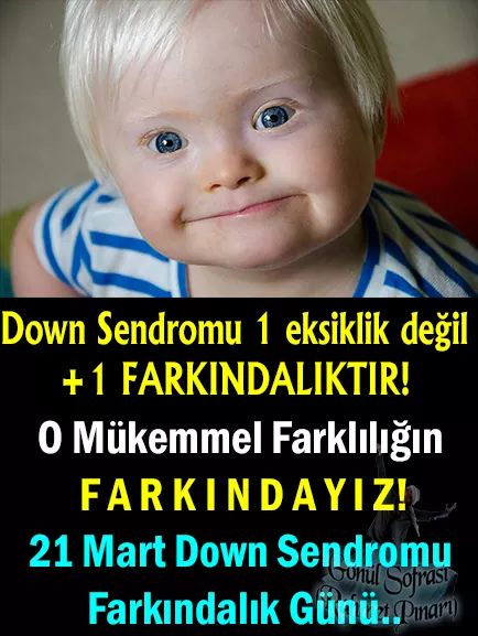 Cemileoz55's tweet photo. O Mükemmel Farklılığın F A R K I N D A Y I Z!
21 Mart Down Sendromu Farkındalık Günü...🍀
#DünyaDownSendromuGünü #farkındalık #downsedromu https://t.co/R0oWEooJQZ