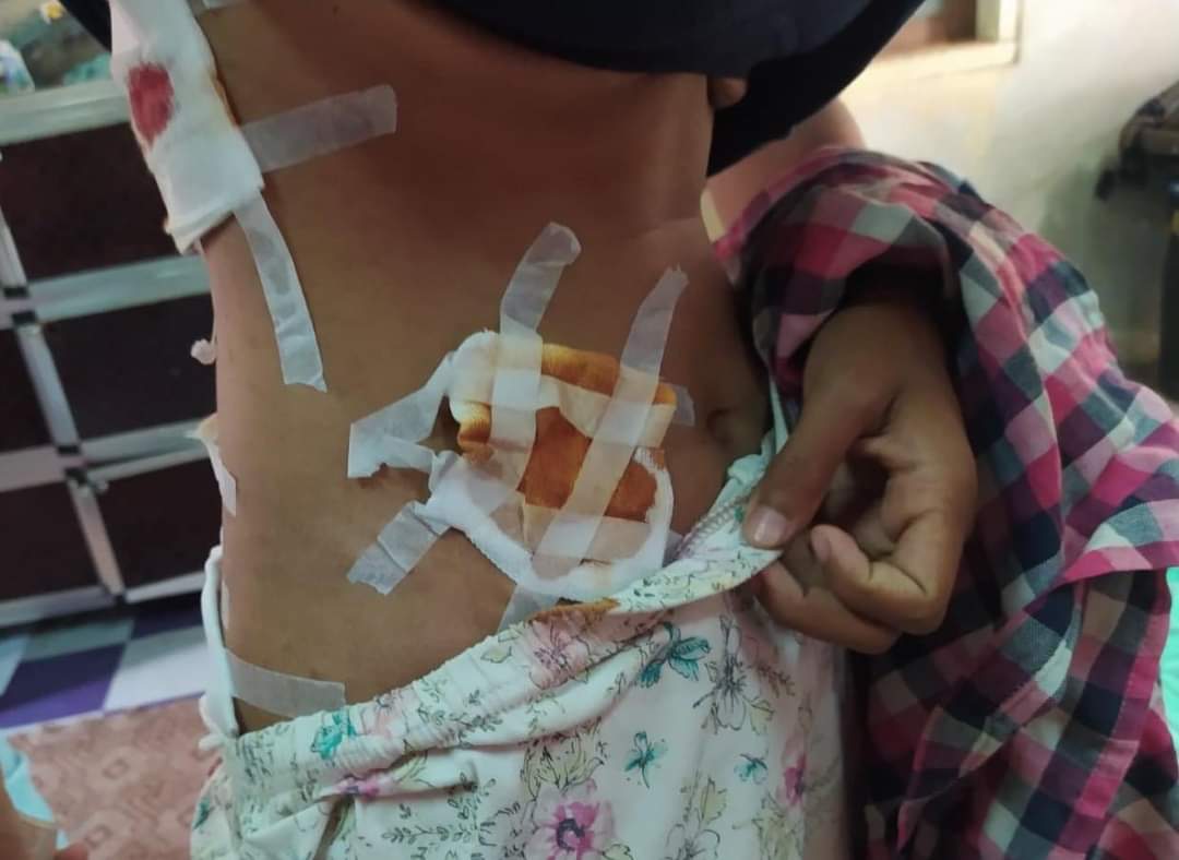 PaingPhyoeThu9's tweet photo. TW // blood
The Junta's Terrorist Group violently crackdown the protesters in #Taunggyi today. 8 were injured and 1 girl got arrested.
#WhatsHappeningInMyanmar
#Mar21Coup https://t.co/I3svzQwm6S