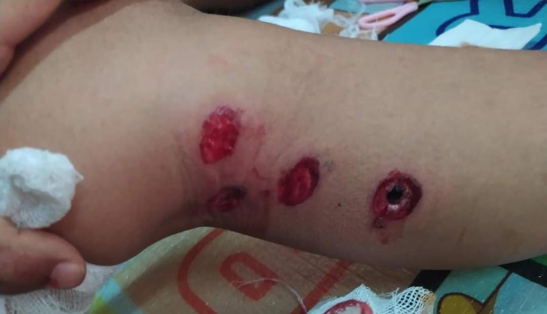PaingPhyoeThu9's tweet photo. TW // blood
The Junta's Terrorist Group violently crackdown the protesters in #Taunggyi today. 8 were injured and 1 girl got arrested.
#WhatsHappeningInMyanmar
#Mar21Coup https://t.co/I3svzQwm6S