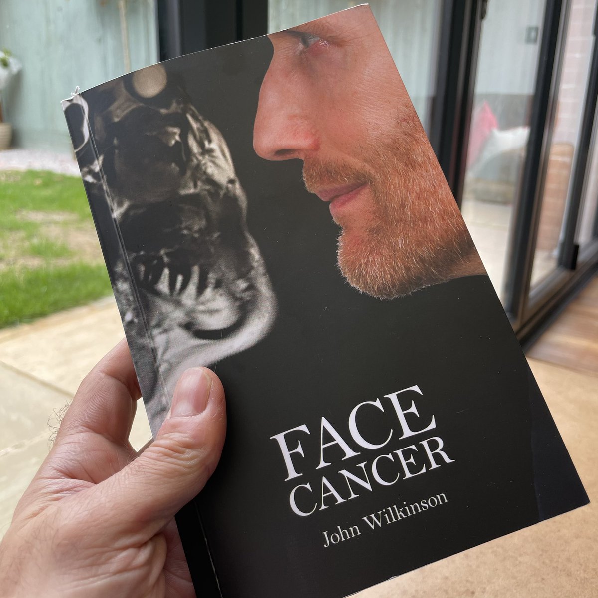 ashalexcooper's tweet photo. So much respect for John & his family. Not only did he manage to write a brutally honest & authentic book about his journey but he did it with humour, humility & an incredibly positive attitude. Rest in peace & be proud of all that you’ve done to help inspire others.
#facecancer https://t.co/QSeE6MHBs1