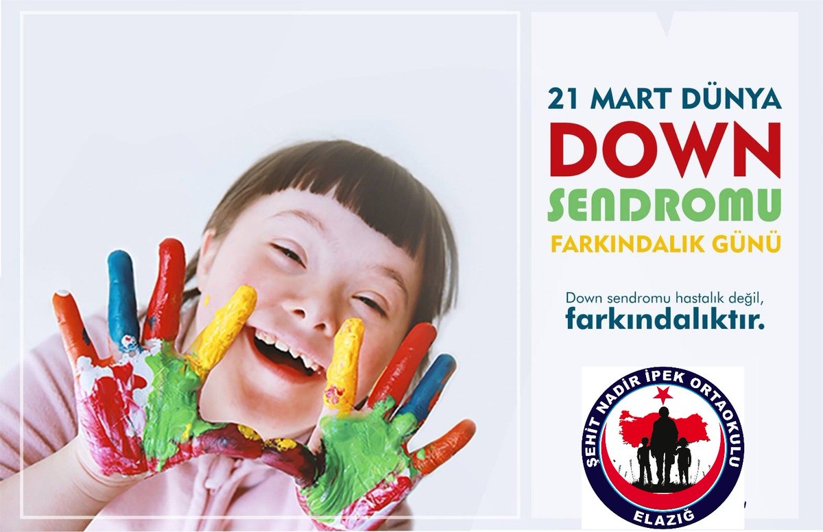 solhanfarabi's tweet photo. Down Sendromu hastalık değil farkındalıktır.
@bingolmem @RahmiGuney @yusuf_tokus @IlceSolhan @IhsanYanilmaz @doner_mahfuz @feritokuyan12g1 @CicekCihat12 @EsraYal74168533 @bburkuk https://t.co/EEI8es3z8H