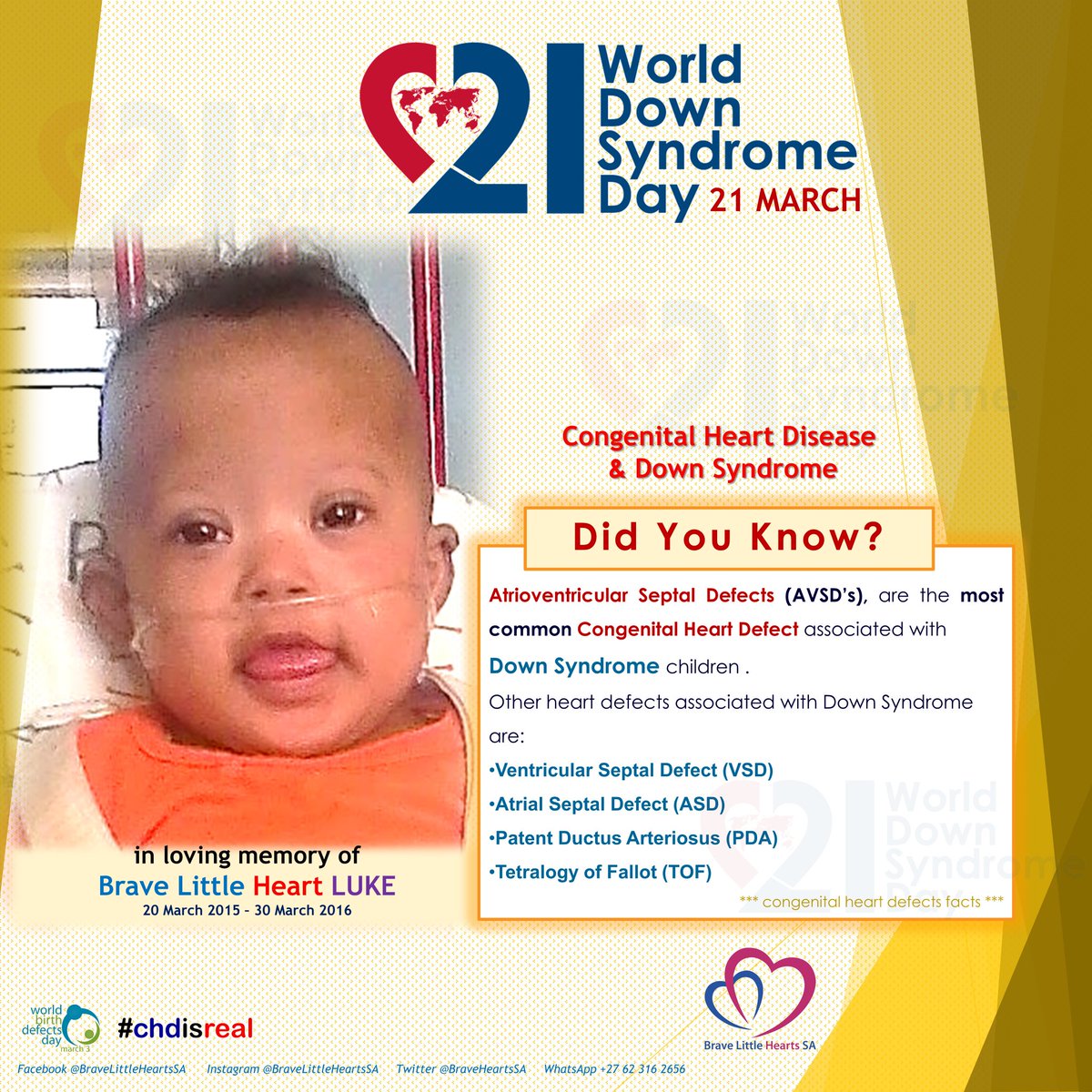 BraveHeartsSA's tweet photo. #chdisreal #chdcare4life #CHDandDownSyndrome 
@WDSD_RAC_COSMO

Did you know? 
The most common heart defect in #DownSyndrome children is #Atrioventricular Septal Defect (AVSD)
#Atrioventricular_Septal_Defects (AVSD’s), are the most common. https://t.co/hSt9n5xECZ