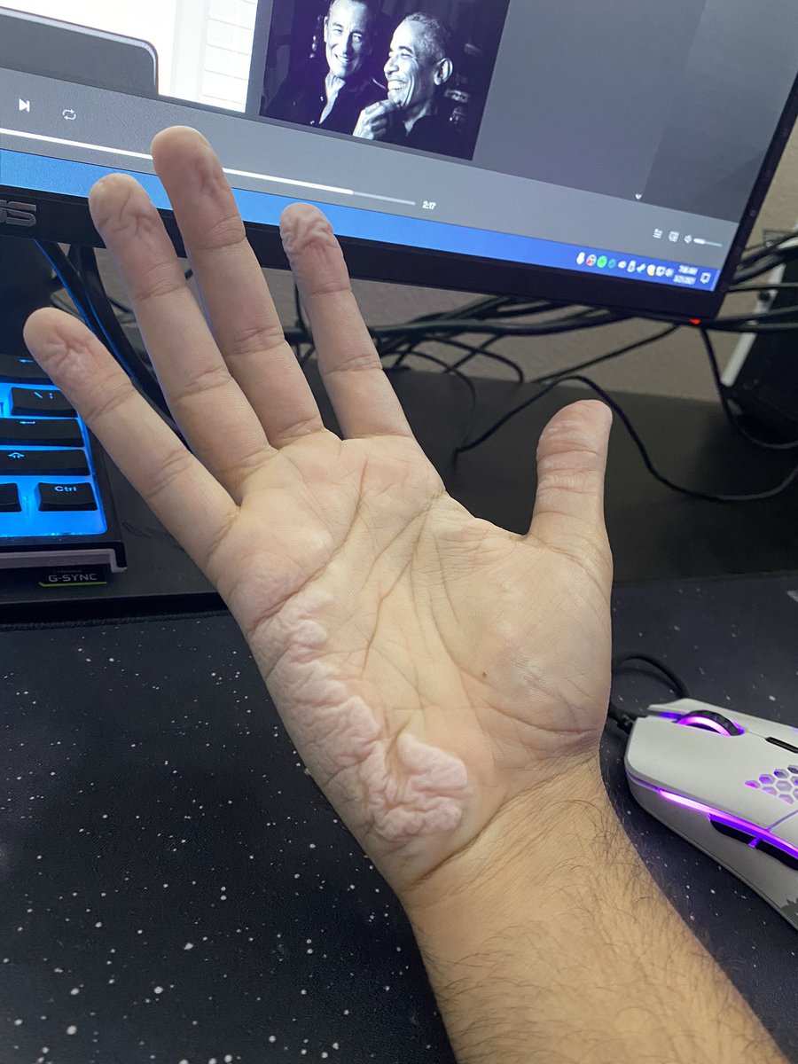 Shadyluls's tweet photo. What 14+ hours into a @MrBeast contest looks like 😅 #fingerontheapp2 https://t.co/9DKryoHQWP