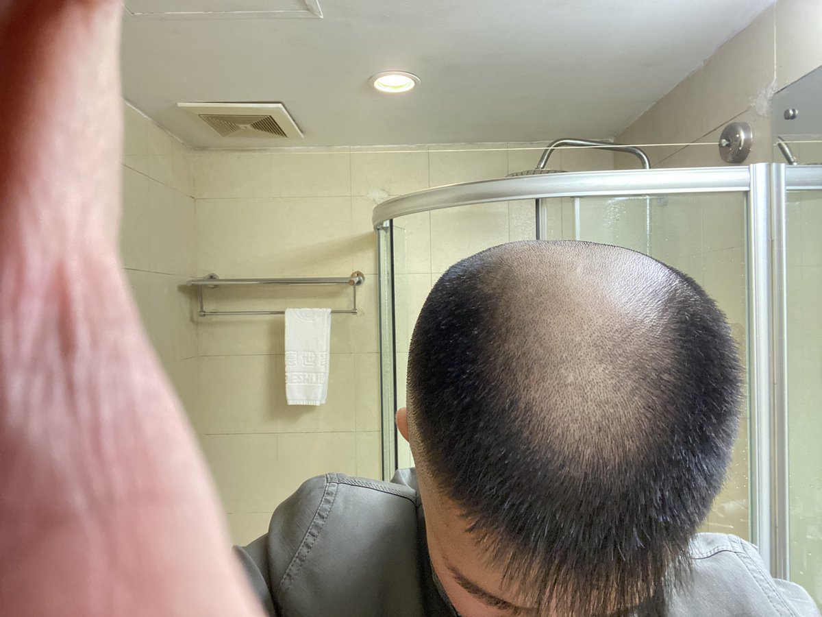 平头民工 tweet media