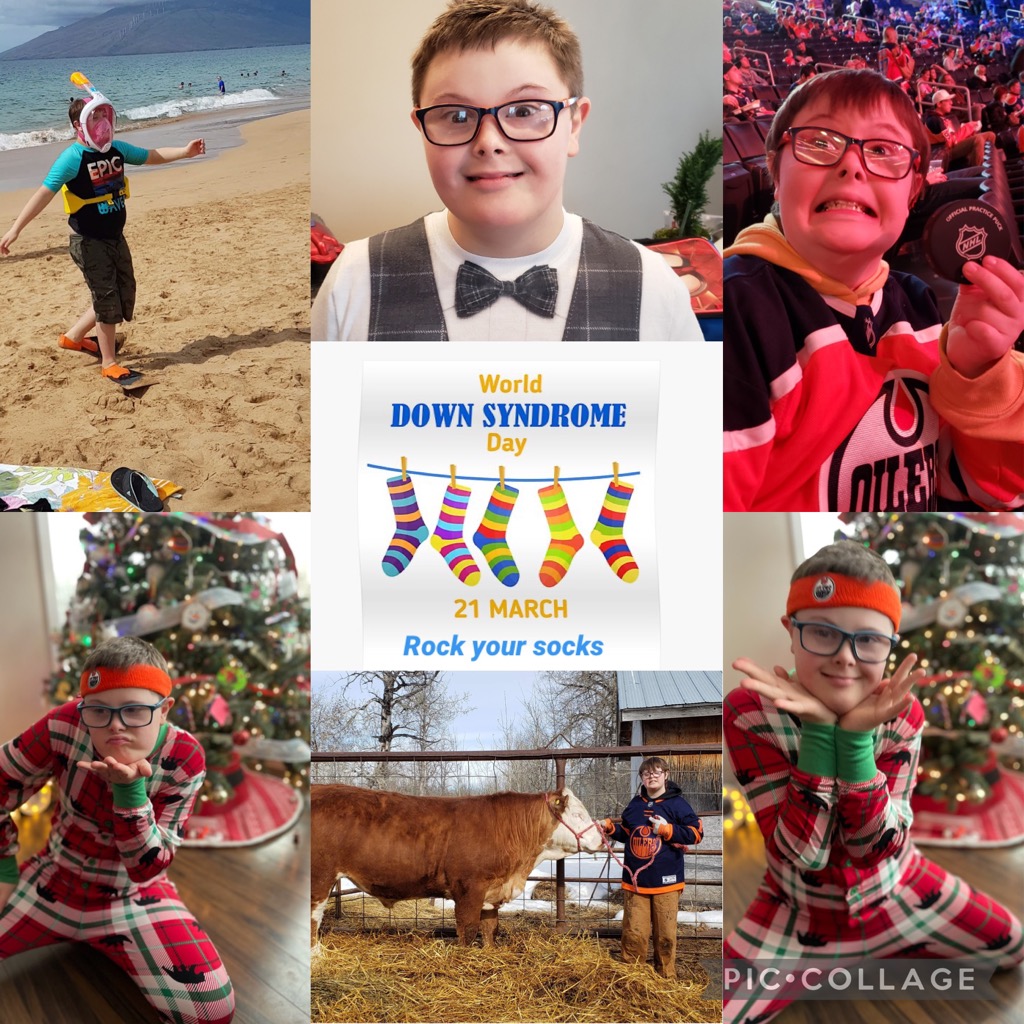 yota_master's tweet photo. Hey @EdmontonOilers and 40 some followers, Braxton wants to see you rock your socks for #WorldDownSyndromeDay! #showmeyoursocks https://t.co/4smYGzKoy5