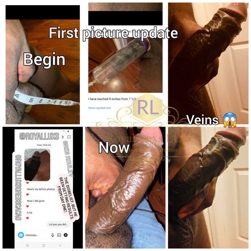 luxs_ti's tweet photo. Real customer results
And if you already got a big 1 why not make it BIGGER
#RoyalLux got hottest natural #penisgrowth ointment #greascacao and #koulev
https://t.co/HKItp2qJaO
https://t.co/wLPA3PEe0X
#bigdick #bigcock #bigblackdick #mandingomondays #mandingomonday https://t.co/rKYYFLy27p