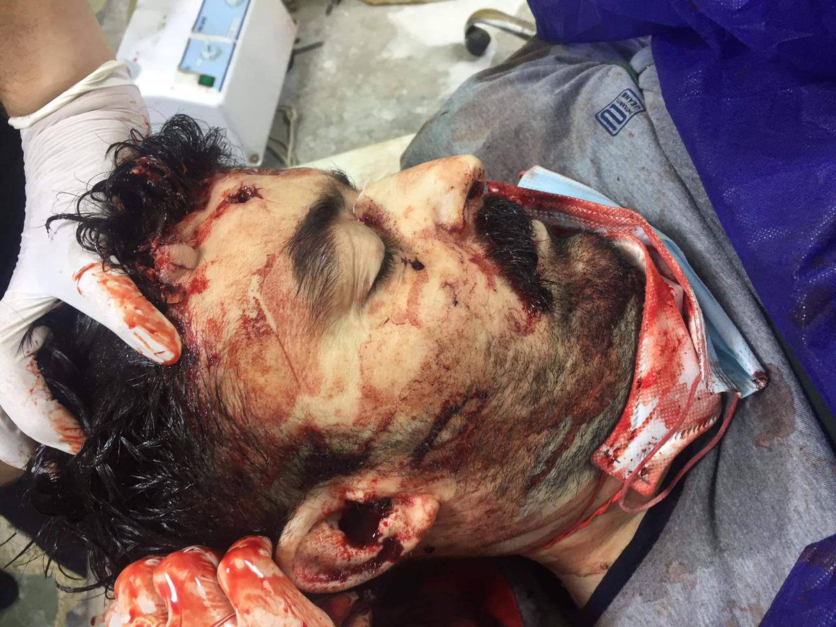 IRaqiRev's tweet photo. WARNING GRAPHIC +18

قبل حوالي ساعتين، اغتيال المقدم في جهاز المخابرات العراقي "محمود ليث" قرب شارع 14 رمضان في بغداد

تأتي عملية الاغتيال هذه بعد حملة تحريضية قادتها الفصائل الولائية لايران وعلى رأسهم قيس الخزعلي ضد جهاز المخابرات، حيث ادعوا ان الجهاز يتم إدارته من قبل الامارات https://t.co/fCkjQK7to1