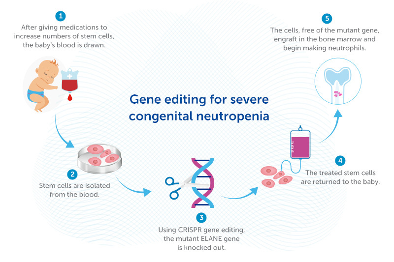BCH_Innovation's tweet photo. Rather than correct the ELANE mutations causing severe #congenitalneutropenia, a gene editing approach developed by @danielevanbauer @DFBC_PedCare knocks the gene out completely: https://t.co/vExggPowun https://t.co/K8HseT9l2h