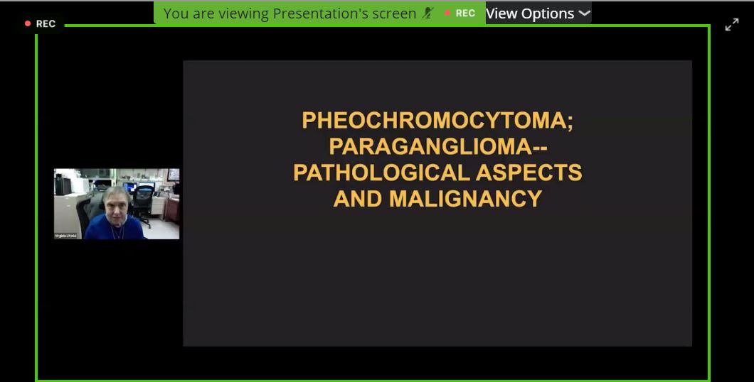 LMFendo's tweet photo. @emiliampinto @TheEndoSociety Next up: Virginia LiVolsi discussing #histopathologic markers for aggressive #pheo #para 

#ENDO2021 https://t.co/qs2uthyKI5