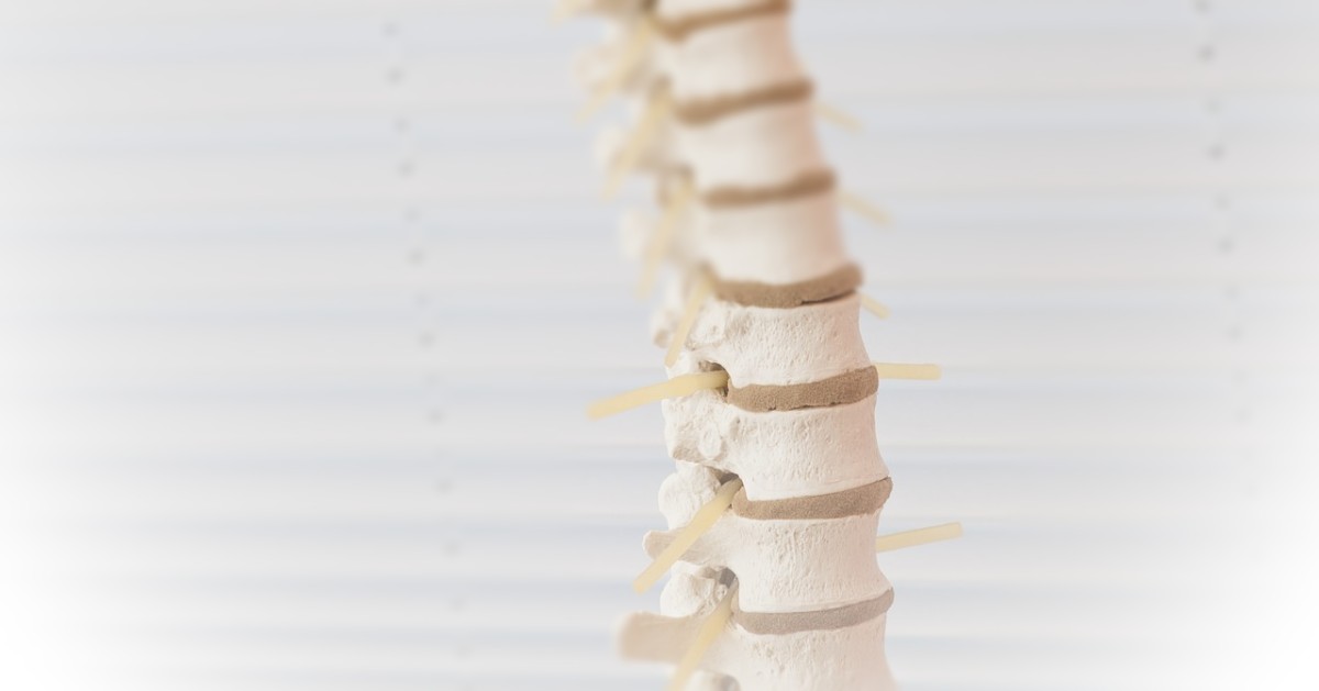 MendColo's tweet photo. Size Of Lumbar Disc Injury Does Not Predict Future Back Surgery
https://t.co/anls4jaz5F https://t.co/Yj3FJRujJH