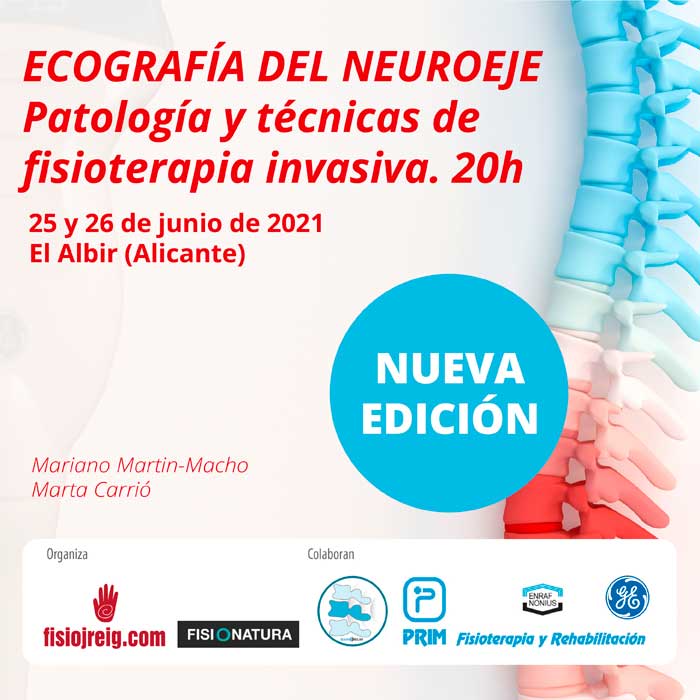 💁 Fisio, aquí dos cursos sobre ecografía músculo-esquelética avanzada que te pueden ayudar y mucho en tu día a día...
✅ Curso 'Eco' Lesiones deportivas 'Córdoba' en mayo: bit.ly/3tsfsa8
✅ Curso 'Eco' Neuroeje 'El Albir' en junio: bit.ly/3vAtWXv #fisio