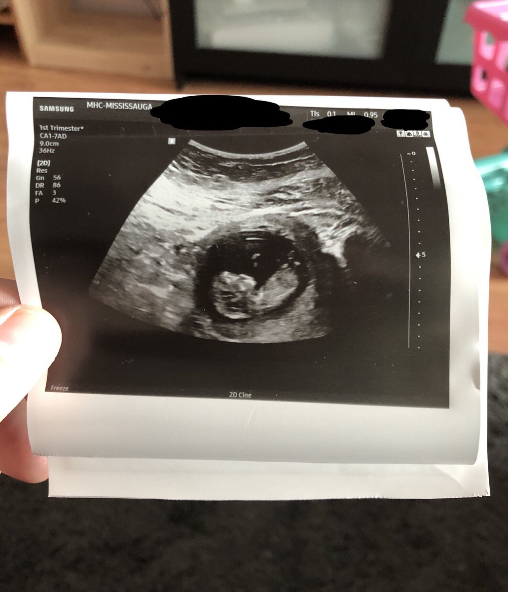 Took an L on the <a href="/wrathsoftware/">maxh</a> restock but this is a better W. #2 on the way 🤰🏻🙌🏼