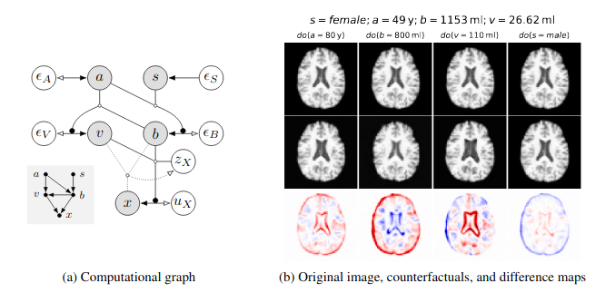Montreal_AI's tweet image. Deep Structural Causal Models for Tractable Counterfactual Inference

Nick Pawlowski, Daniel C. Castro, Ben Glocker: arxiv.org/abs/2006.06485

#DeepLearning #CausalModels #CounterfactualInference