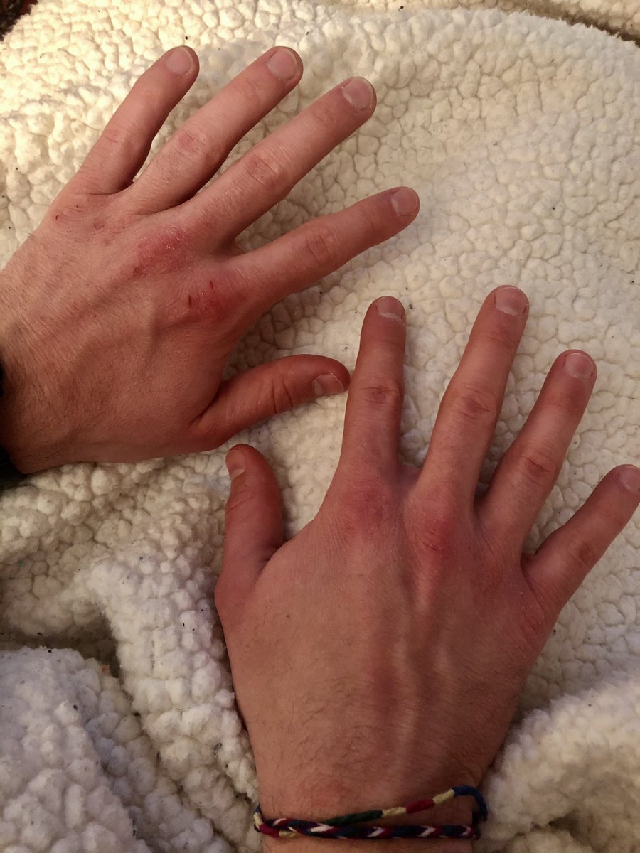 plusjake's tweet photo. My hands look like this so hers can look like this https://t.co/K3xIUPNMjn
