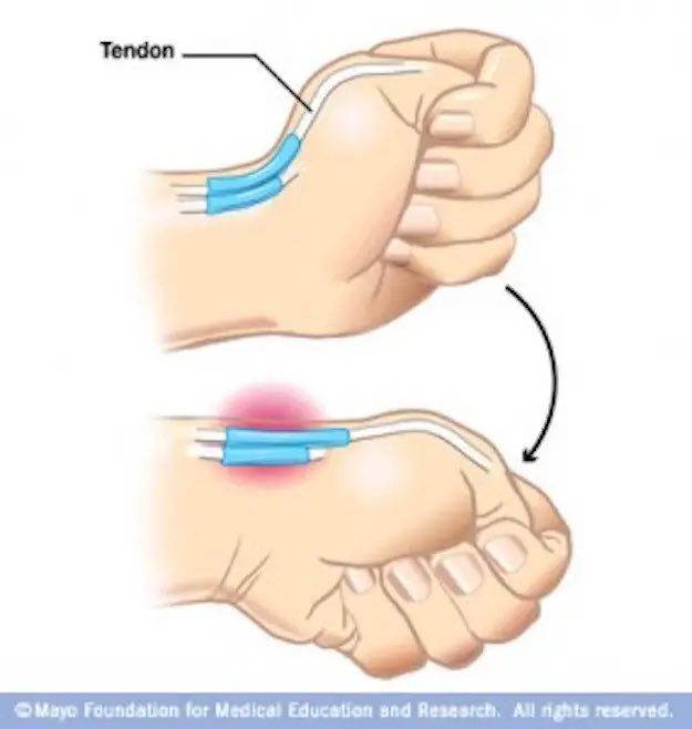 StopColyanMe's tweet photo. One night I saw this diagram and decided to try it. Couldn’t move my thumb for days https://t.co/oDKTEaiVuO
