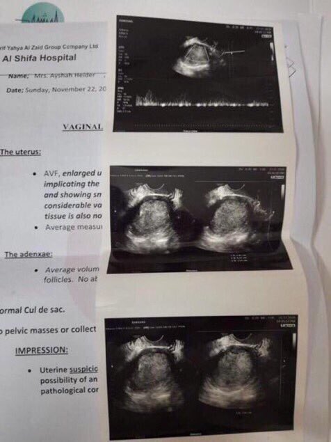 <a href="/hfc_am1/">عبدالسلام الحارثي</a> <a href="/muedhx/">Omar</a> السلام عليكم ورحمه وبركاته الله يسعد صباحك استاذ عبدالسلام والداتي عندها ورم سرطان ويحتاجون نسوي لها عمليه استيصال الورم وقيمه العمليه 30 الف وتم جمع مبلغ 28200 الف والمتبقي من المبلغ 1800ريال وانشالله اهل الخير مايقصرون ويكتمل المبلغ يارب والله حالتنا الماديه سئيه جدا ساعدنا