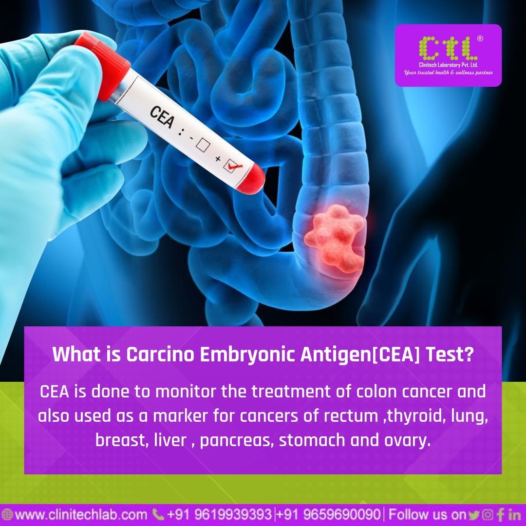 ClinitechL's tweet photo. CEA Test is now available at CTL only at Rs 760/-
------------------------------------------
Contact us here to get yours done:
+91 9619939393 +91 9659690090
Book your home visit: https://t.co/vHC3VYKtwb
Website: https://t.co/rvs12mfS7h

#CTL #ctllab #technology #covid19 #he https://t.co/cpGgKx1qzf